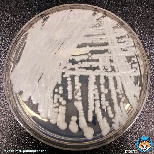 Drug-resistant Candida auris spread &lsquo;worrisome&rsquo; say epidemiologists
