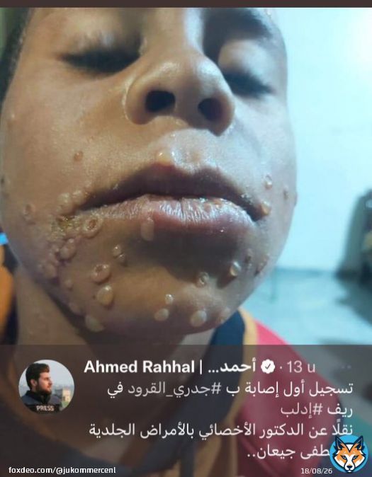 Het blijft wel vreemd dat een virus dat al heel lang bestaat ineens op wereldreis gaat.   Dan heb je nog de verdachte case uit Idlib, Syri&euml; en de complottheorie van Bill Gates:    Kan het zijn dat Bill Gates zijn conspiracy theorie klopt?