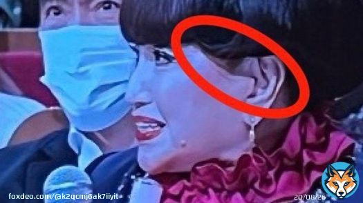 #紅白 、私は直接見ていないのですが、 #黒柳徹子 #小室哲哉 #福山雅治 #氷川きよし だそうです。 みんな耳の所に謎の境目が。 大泉洋も変だったって言う人もいました。
