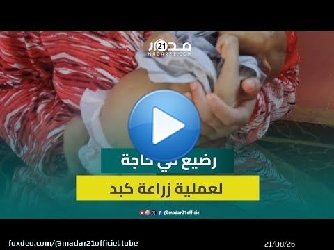 حالة إنسانية مُؤثِرة.. أم تناشد إنقاذ رضيعها عبر عملية زراعة الكبد