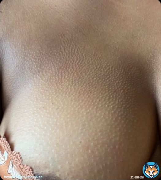 I am sending my Free no bra pics to anyone that types SEND