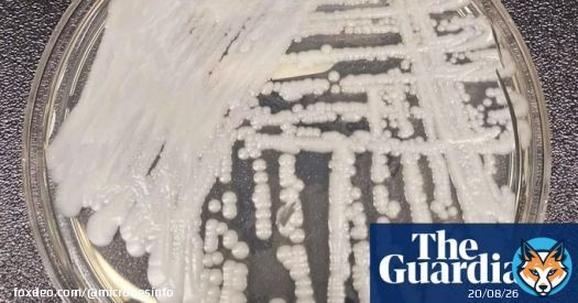 World ill-equipped for the dangers of #fungal #infections ...   | #fungi | #Cordyceps | #fungus | #climatechange | #Ophiocordyceps | By @LindaGeddes via @guardian