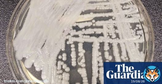 World ill-equipped for the dangers of #fungal #infections ...   | #fungi | #Cordyceps | #fungus | #climatechange | #Ophiocordyceps | By @LindaGeddes via @guardian