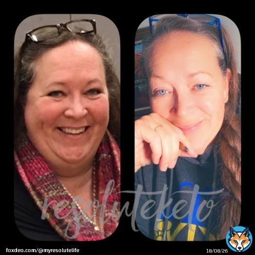5 years ago my cardiologist convinced me to go lowcarb and it saved my life. Today, my health is still improving, I&rsquo;ve lost 155 lbs, I have a normal A1c as a #t1d, #lupus in remission, and my focus is on helping others improve their own health too. #diabetesawarenessmonth  #keto