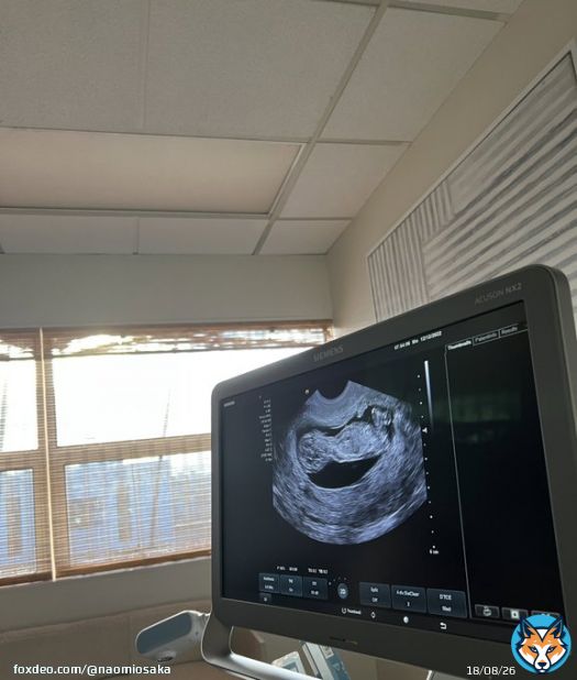 Can&rsquo;t wait to get back on the court but here&rsquo;s a little life update for 2023.