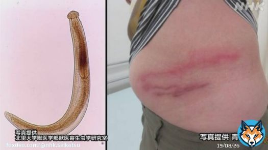 【寄生虫の原因は？】 皮膚の下に寄生虫が入り込み、かゆみや腫れなどを引き起こす「顎口虫（がっこうちゅう）」  青森県で症状を訴える人が確認されました  多くの患者がシラウオを生で食べていたということで、青森県は加熱するよう呼びかけています