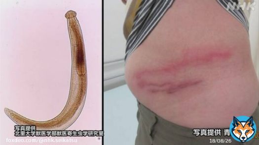 【寄生虫の原因は？】 皮膚の下に寄生虫が入り込み、かゆみや腫れなどを引き起こす「顎口虫（がっこうちゅう）」  青森県で症状を訴える人が確認されました  多くの患者がシラウオを生で食べていたということで、青森県は加熱するよう呼びかけています