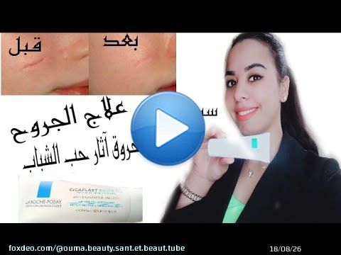 أرخص بومادا\ud83e\uddf4cicaplast لعلاج آثار حب الشباب و الجروح والندوب في أسبوع وجهك يرجع حسن من الأول\ud83d\ude4b