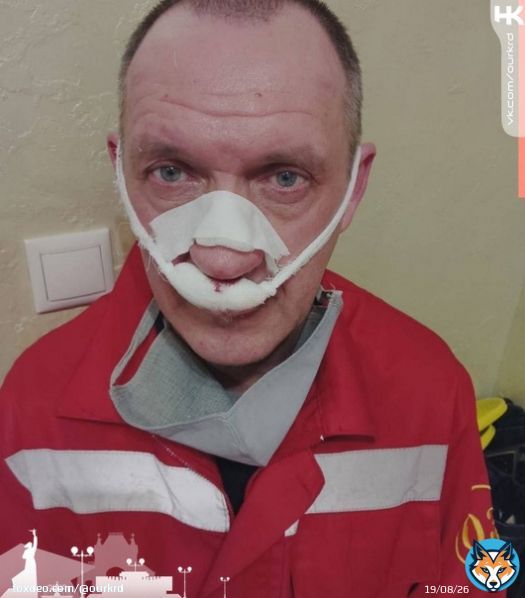 В Краснодаре мужчина-пациент напал на врача скорой помощи и сломал ему нос.    #Кубань #КраснодарскийКрай #KRD #Краснодар