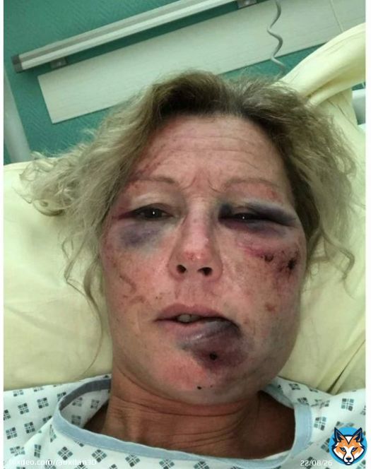 Beziers: Une femme de 50 ans a &eacute;t&eacute; cambriol&eacute;e et rou&eacute;e de coups par ses agresseurs. Elle a &eacute;t&eacute; laiss&eacute;e pour morte. La barbarie et la violence se propage partout en France.. #BFMTV #cnews #GGRMC #hdpros