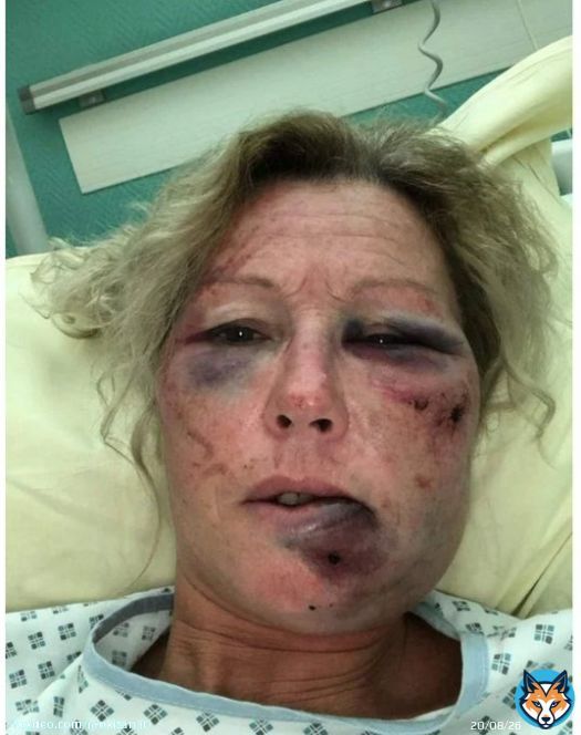 Beziers: Une femme de 50 ans a &eacute;t&eacute; cambriol&eacute;e et rou&eacute;e de coups par ses agresseurs. Elle a &eacute;t&eacute; laiss&eacute;e pour morte. La barbarie et la violence se propage partout en France.. #BFMTV #cnews #GGRMC #hdpros