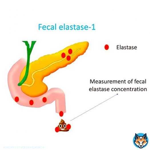 FECAL ELASTASE-1: A thread   Enzyme product of normal pancreatic secretion  Remains 'relatively' stable during digestion  Indirect measure of pancreas function  can help dx EPI   Sensitivity & Specificity of indirect pancreas function tests  Showow more