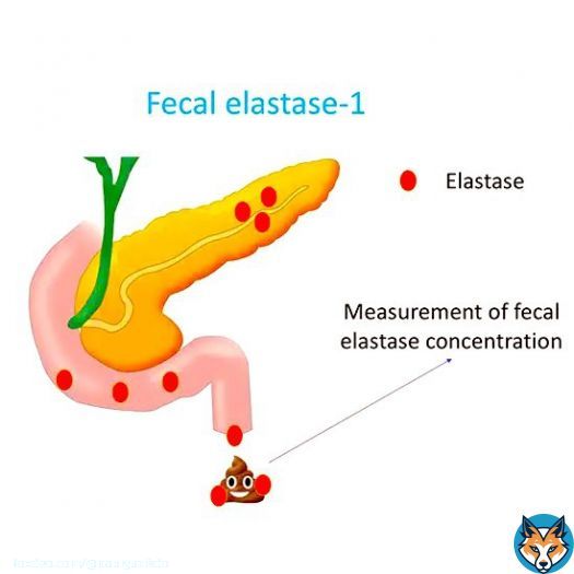 FECAL ELASTASE-1: A thread   Enzyme product of normal pancreatic secretion  Remains 'relatively' stable during digestion  Indirect measure of pancreas function  can help dx EPI   Sensitivity & Specificity of indirect pancreas function tests  Showow more