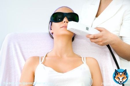 IPL laserhairremoval #upperlip - cosmetic procedure performed in #Princeton NJ.  #laserhairremovalnj #laserhairremovalnearme #laserhairremovalprinceton #princeton #lawrencevillenj #medspa ##beauty #beautiful #fashion #photooftheday #bestoftheday #antiaging