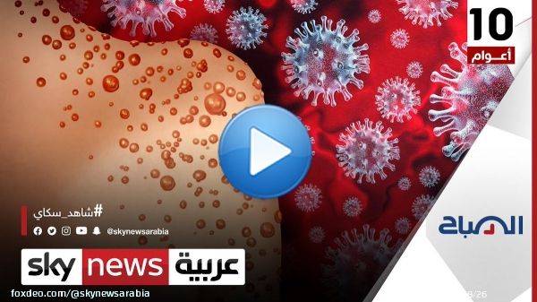 هل استخلص العالم العبر من أزمة #كورونا لمواجهة #جدري_القردة؟  #الصباح