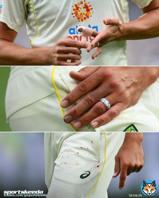 Mitchell Starc is a warrior   #CricketTwitter #ausvssa
