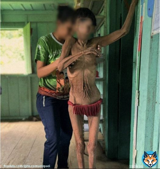 N&atilde;o Chamem de Trag&eacute;dia algo que poderia ser evitado. O que Bolsonaro fez com os Yanomami em Roraima foi Genoc&iacute;dio, Assassinato, Tortura, Corrup&ccedil;&atilde;o, M&eacute;todo Nazifascista de Matar Povos e Culturas originais.   OGoverno Bolsonaro cometeu GENOC&Iacute;DIO contra os &iacute;ndios do Brasil.