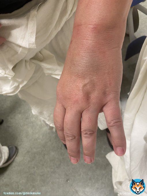 Staff members at red rocks were not doing anything to help us. BOTH of my moms hands are broken just because she wanted to protect my friend and I. We&rsquo;re all in the hospital and some employees at Red Rocks were laughing and videoing people sobbing, scared, and in pain