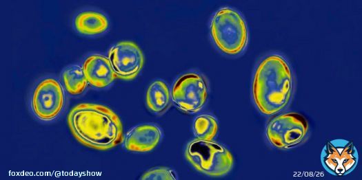 More than half the U.S. has reported cases of Candida auris as of late 2022, the CDC said.
