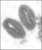 Affenpocken/Monkeypox / جدري القردة Die Affenpocken (auch: Affenpockenkrankheit) sind eine Erkrankung die durch das Affenpockenvirus (offiziell Monkeypox virus, MPV, veraltet Orthopoxvirus simiae)