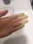 Preg&uacute;ntenle a mi Raynaud si hace fr&iacute;o #enfermedadesraras #lupus #saf