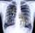 MAX DUGGAN'S X-RAYS JUST DROPPED: