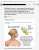 NEW ARTICLE: Multiple Sclerosis (MS) - neurological injury that can be caused or exacerbated by COVID-19 vaccines.   Both Pfizer and Moderna were positioned, with new mRNA products, to profit from these injuries they caused.  Pfizer/BioNTech announce