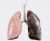 The lung on the right was taken from a man that had worked at a #Bitcoin mine for just ten years  The lung on the left was taken from a man who worked down a coal mine his entire life  Really makes you think