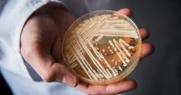 Cases of the drug-resistant fungus Candida auris are now climbing at an "alarming" rate in health care facilities around the country, the CDC warned on Monday, after reports of infected patients nearly doubled in 2021.