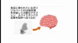 死因非公開ということで　やはり自\u25cbと推察してしまう　大阪の漫才コンビ「青空」須藤理恵さん死去　45歳　毒性物質脳幹膜突破で自死促進、　   #sm42270264 #ニコニコ動画