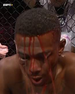 JAMAHAL BEFORE THE FINAL ROUND  #UFC283   (h/t @Datowadl5er/TW)
