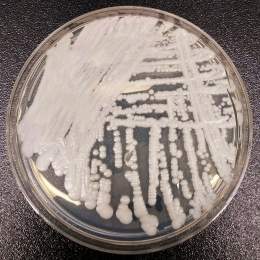 Drug-resistant Candida auris spread &lsquo;worrisome&rsquo; say epidemiologists