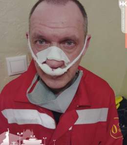 В Краснодаре мужчина-пациент напал на врача скорой помощи и сломал ему нос.    #Кубань #КраснодарскийКрай #KRD #Краснодар