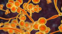 The fungus, Candida auris, was identified in Asia in 2009 but was first reported in the US in 2016. The number of infections in the country has risen by 95% between 2020 and 2021