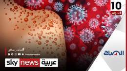 هل استخلص العالم العبر من أزمة #كورونا لمواجهة #جدري_القردة؟  #الصباح