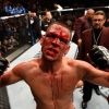 ufcworldsbest